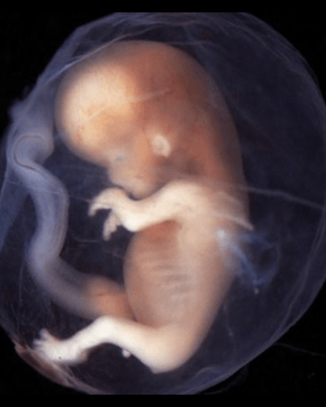 [Updated dates] CILE Professor Lectures on the Beginning of Human Life in London (23-24 September 2017)